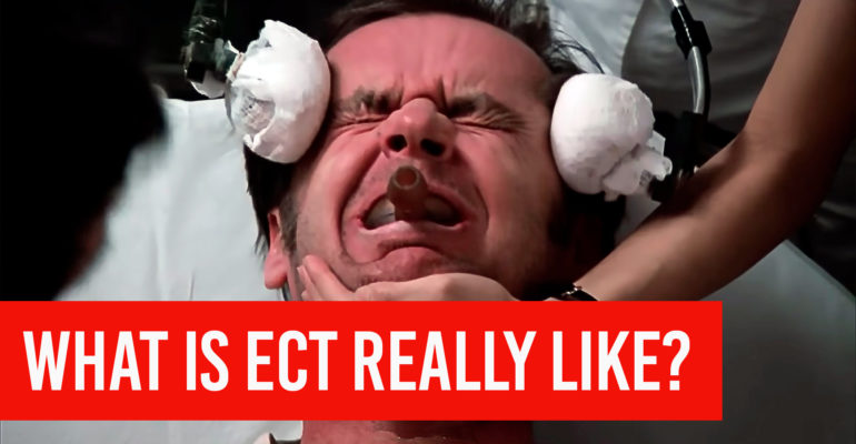 electroconvulsive therapy ect what is it